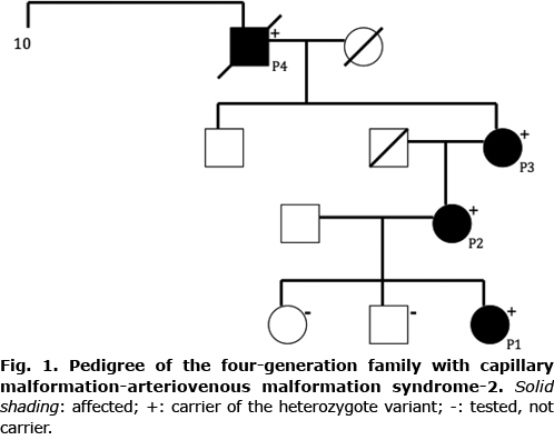 We report here a four-generation family with CM-AVM2 ( Fig. 1 ).