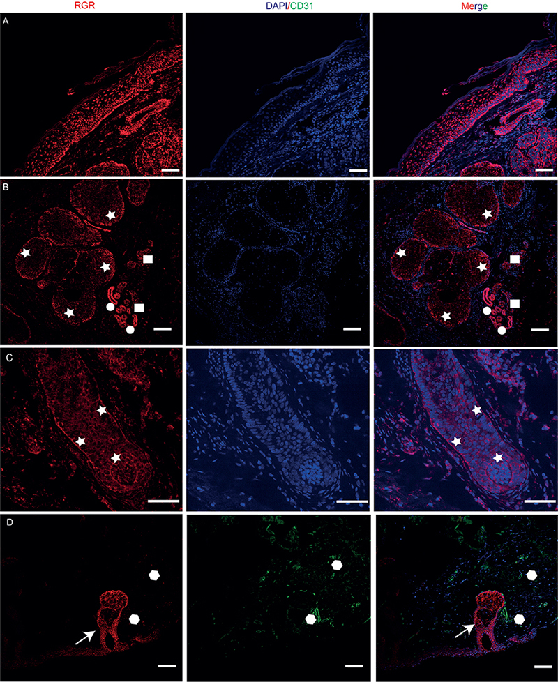 Expression Analysis of Retinal G Protein-coupled Receptor and its ...