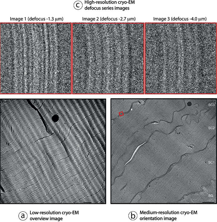 Molecular Organization of the Skin Barrier