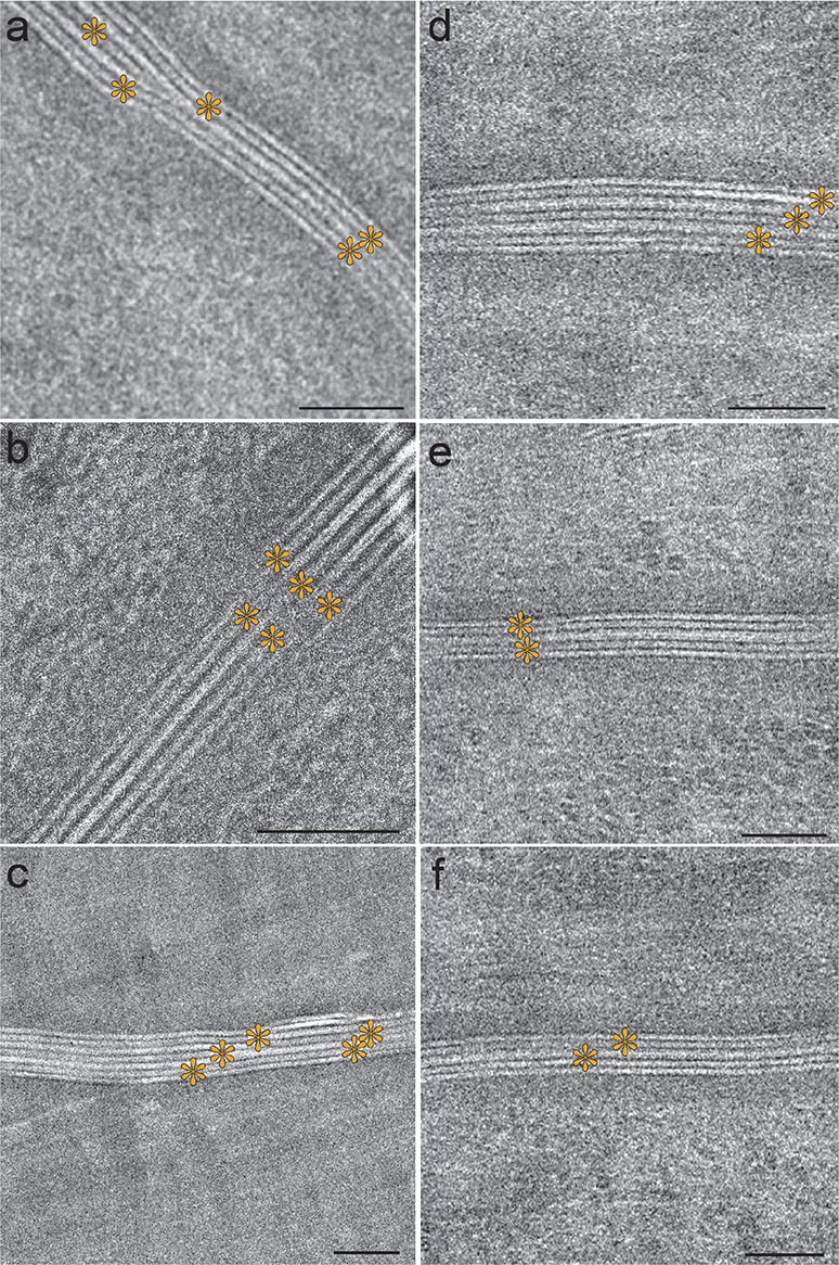 Molecular Organization of the Skin Barrier