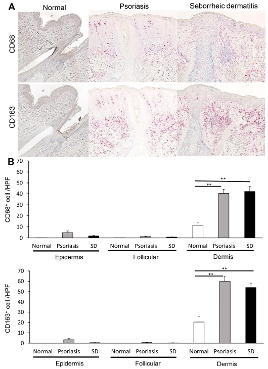 Dendritic cell clusters in the perifollicular areas of the dermis