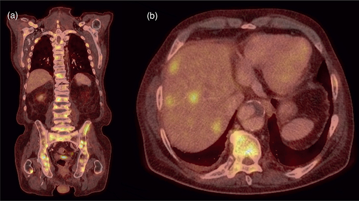 Figure 32