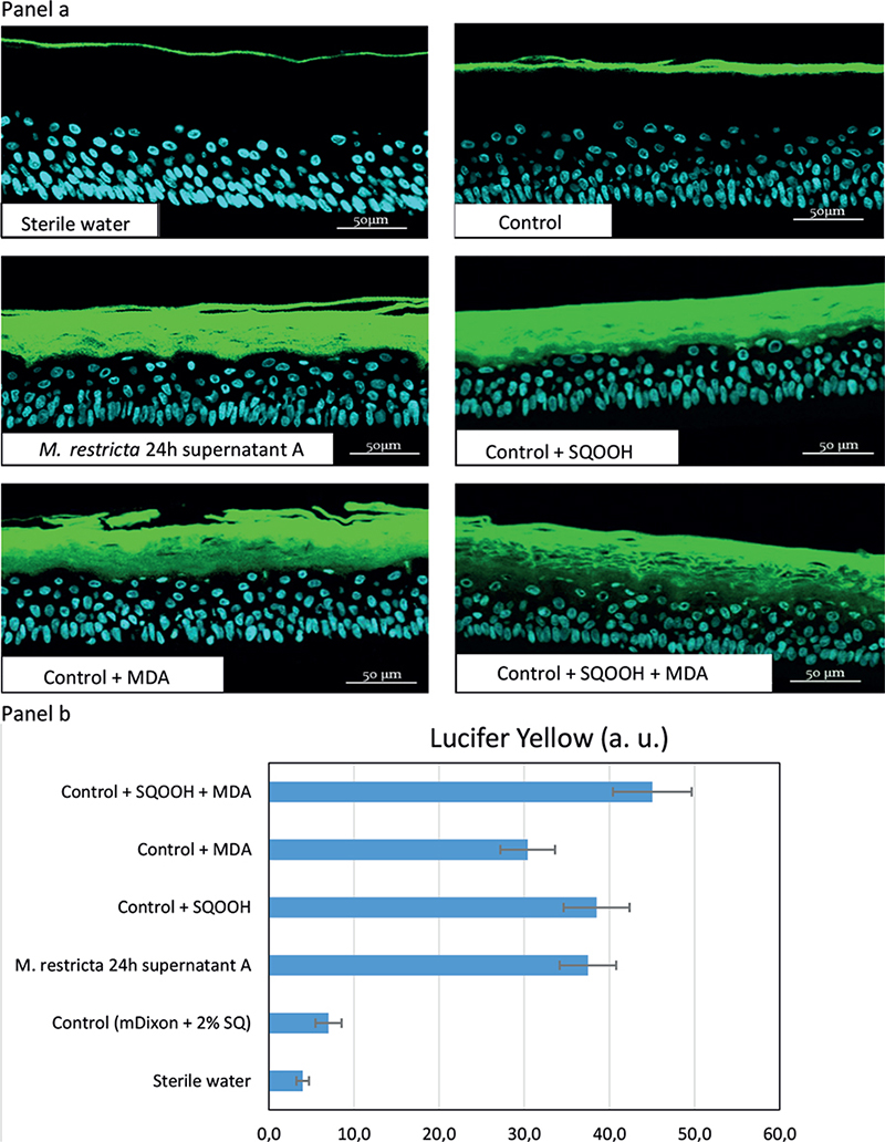 Malassezia restricta-mediated Lipoperoxidation: A Novel Trigger in Dandruff