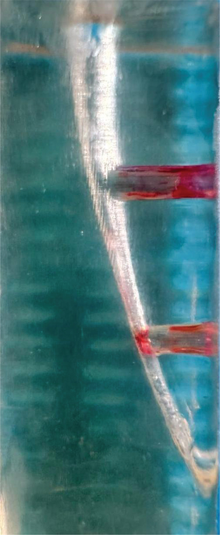 Comparison of the effectiveness of different ırrigation activation ...