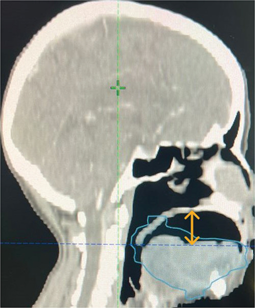 Figure 7
