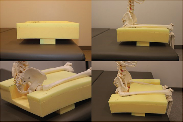 OFF-LOADING PRESSURE RELIEF WITH FOAM CUT OUT CUSHIONS: EXPERIENCES ...