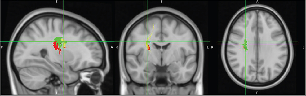 Figure 9