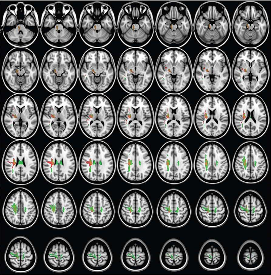 Figure 11