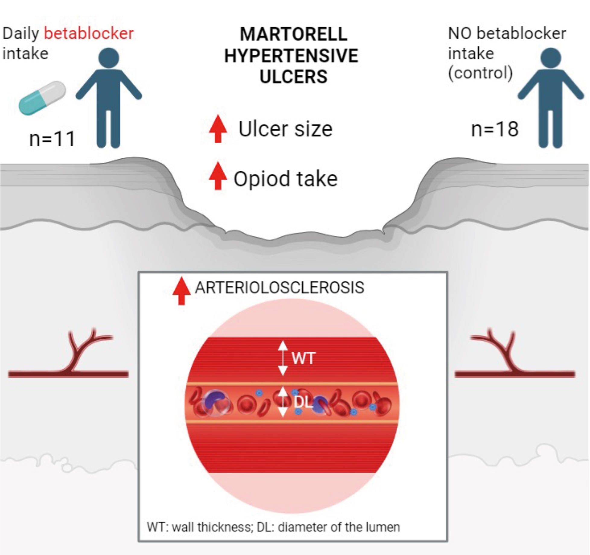 Effect of betablockers on the course of Martorell hypertensive ulcers